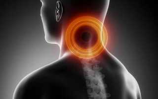Почему болит горло и шея по обоим бокам, с правой стороны или сзади