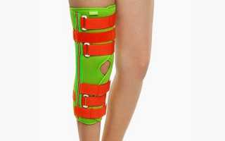 Что такое тутор на коленный сустав. виды фиксаторов, рекомендации по использованию
