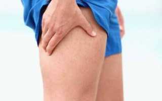 Возникновение боли в ноге в области от бедра до колена