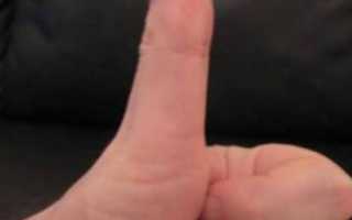 Причины нарушения движений в пальцах рук