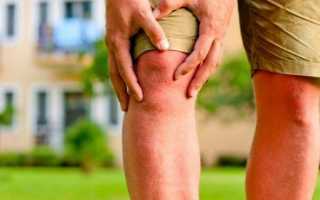 Боль в суставах ног: причины, симптомы, диагностика, лечение
