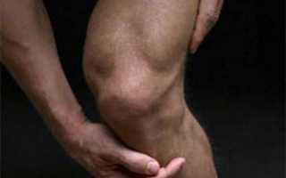 Причины и лечение синовита коленного сустава: препараты и народная медицина