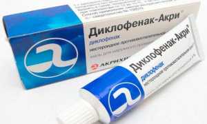 Воспаление коленного сустава — лечение медикаментами