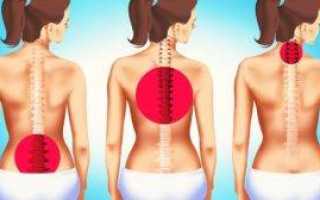 Почему болит позвоночник посередине спины? методы лечения и устранения боли