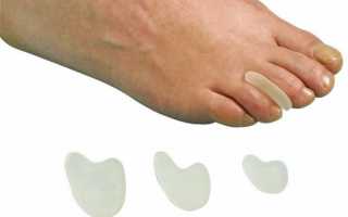 Ортопедические накладки на пальцы ног