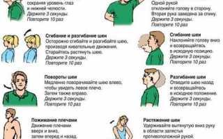 Синдрома плечо кисть синдром стейнброкера