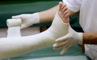 Особенности перелома большого пальца на ноге