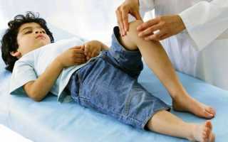 Ювенильный идиопатический артрит у детей: симптомы и лечение