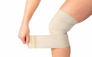 Растяжение связок коленного сустава: признаки, причины, диагностика и лечение