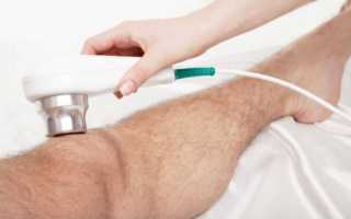 Артралгия коленного сустава у взрослых и детей: симптоматика и методы лечения