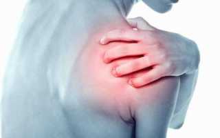 Лечение перелома бугра плечевого сустава и дальнейший последствия