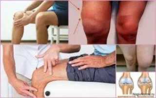 Лечение коленного сустава мочой