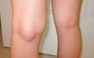 Болят мышцы ног выше колен причины