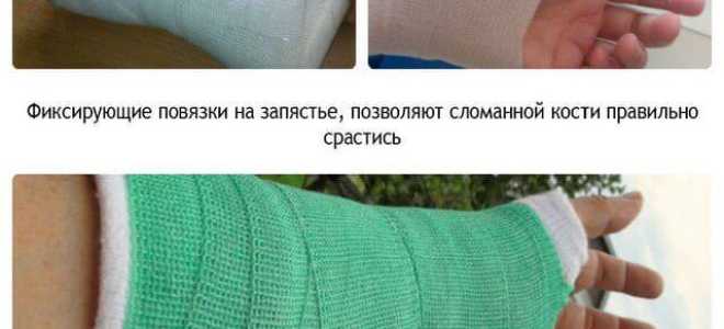 Кости запястья