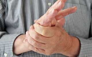 Что делать, если болят суставы пальцев рук: причины и лечение
