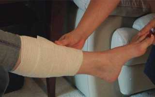 Основные советы специалистов по разработке ноги после перелома