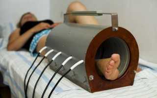 Магнитный наколенник при артрозе коленного сустава, магниты для лечения