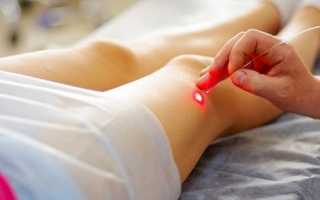 Противопоказания лечение суставов лазером