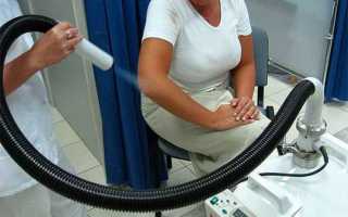 Криотерапия: когда полезен холод в лечении суставов