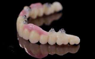 Классификация материалов, применяемых в ортопедических стоматологии. конструкционные и вспомогательные материалы