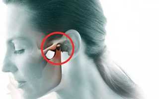 Лечение боли в челюстном суставе боль в челюстном суставе